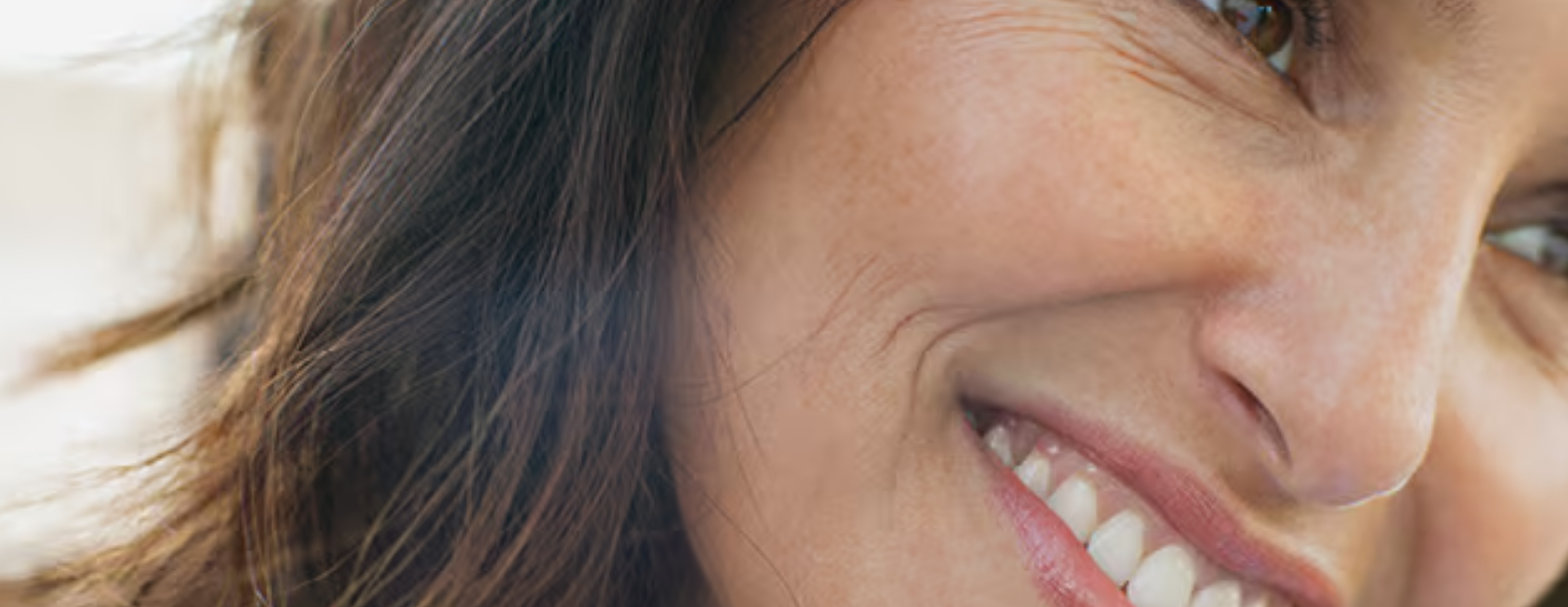 Dysport® cosmetic wrinkle treatment – crow’s feet